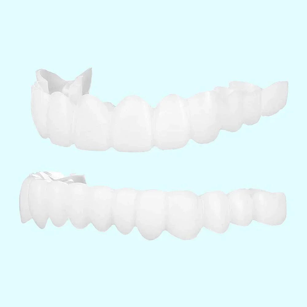 Zahnärztliche Veneers