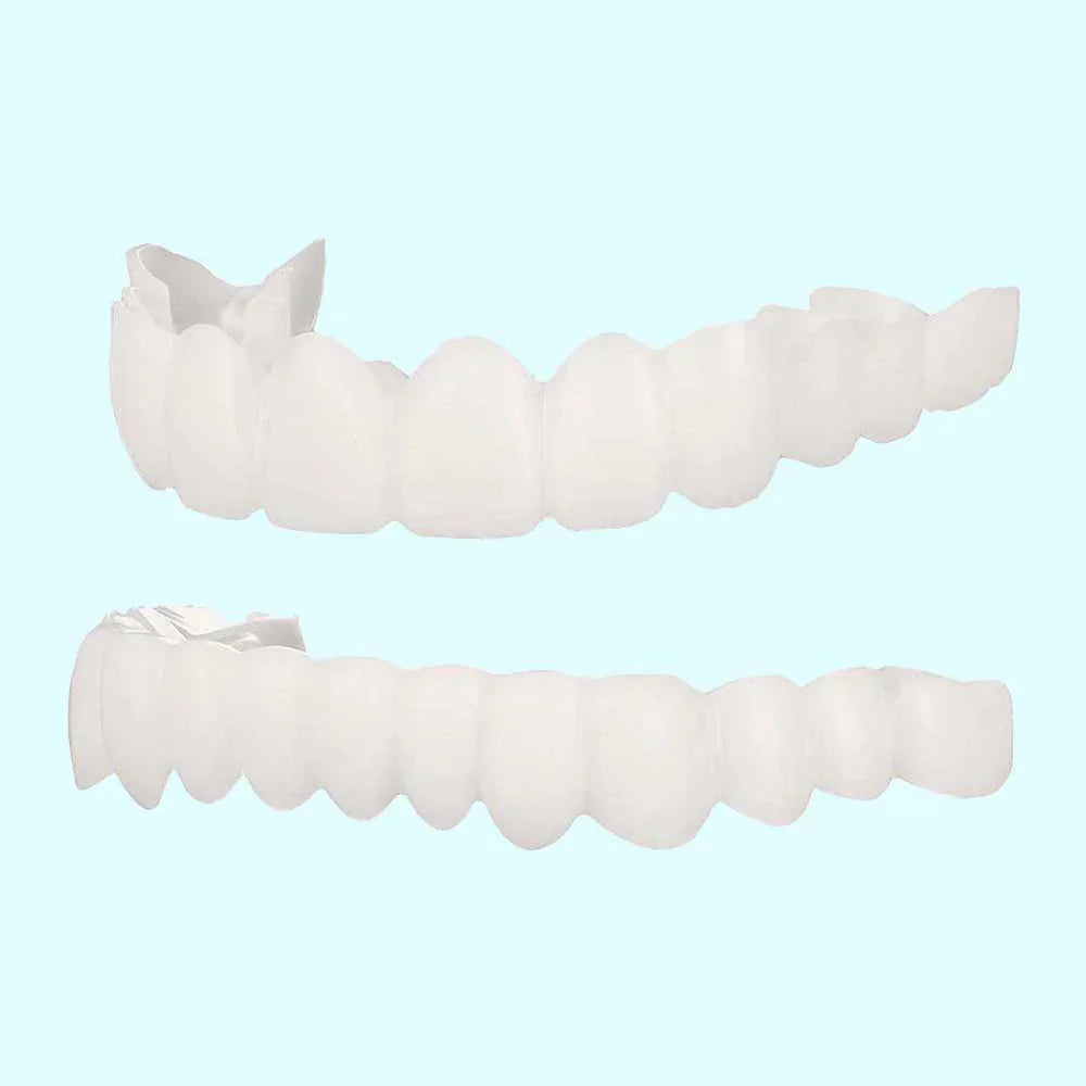 Zahnärztliche Veneers